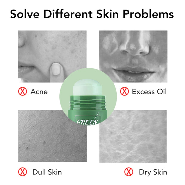 Oil Control Skin Care Anti-Acne Mask